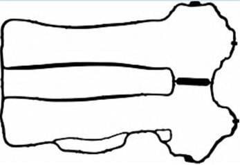 Прокладка клапанної кришки BGAV BGA RC5510