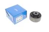 Сайлентблок рычага SKF VKDS335006 (фото 2)